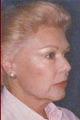 gesicht4_vor