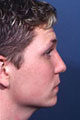 nase3_nach