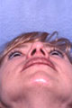 nase4_nach