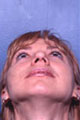 nase4_vor